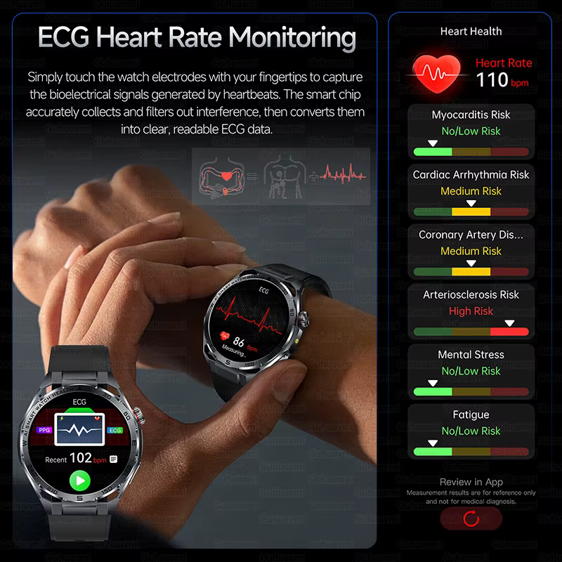 Nouvelle montre connectée ECG pour soins de santé